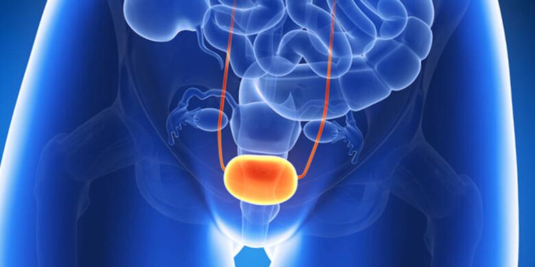 Treatment of inflammation of the bladder with tablets.