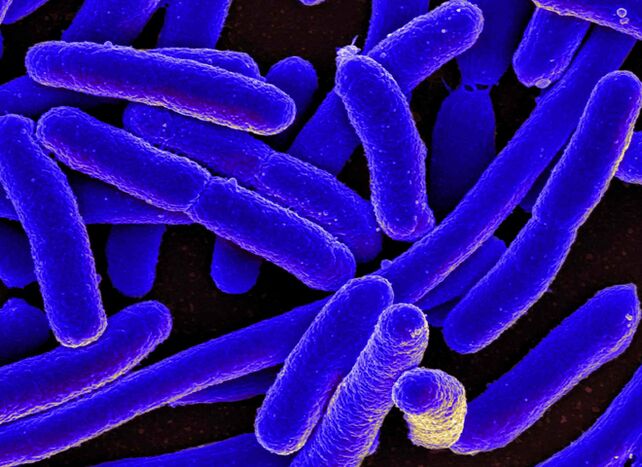 E. coli most often causes the development of cystitis in women.